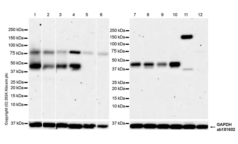 Western blot - Anti-ST8SiaIII antibody [EPR28521-92] - BSA and Azide free (AB317617)