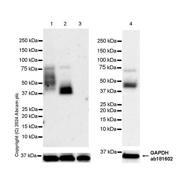 Western blot - Anti-ST8SiaIII antibody [EPR28521-92] - BSA and Azide free (AB317617)