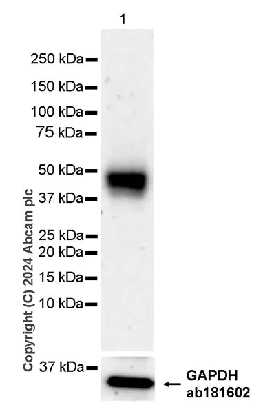 Western blot - Anti-ST8SiaIII antibody [EPR28521-92] - BSA and Azide free (AB317617)