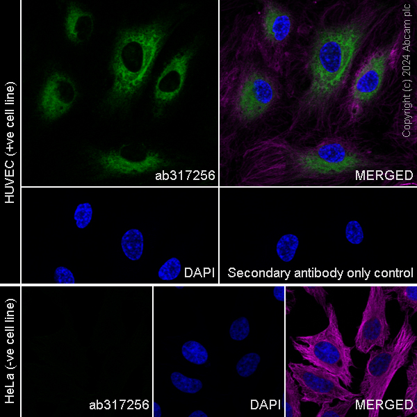 Immunocytochemistry/ Immunofluorescence - Anti-Stabilin-1 antibody [EPR27955-12] (ab317256), expandable thumbnail