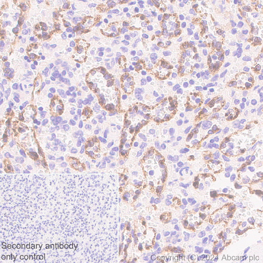 Immunohistochemistry (Formalin/PFA-fixed paraffin-embedded sections) - Anti-Stabilin-1 antibody [EPR27955-12] (AB317256), expandable thumbnail
