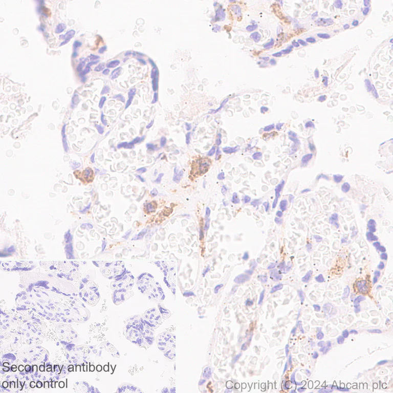 Immunohistochemistry (Formalin/PFA-fixed paraffin-embedded sections) - Anti-Stabilin-1 antibody [EPR27955-12] (AB317256)