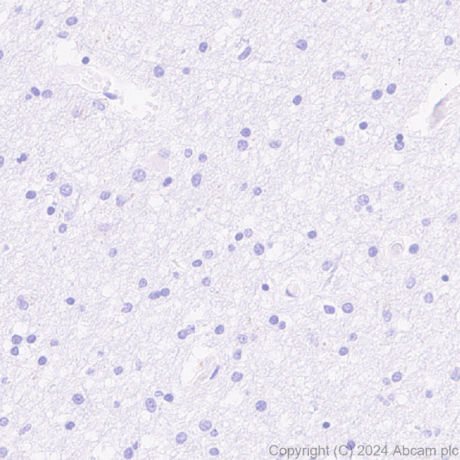 Immunohistochemistry (Formalin/PFA-fixed paraffin-embedded sections) - Anti-Stabilin-1 antibody [EPR27955-12] (AB317256), expandable thumbnail