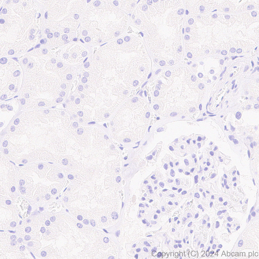 Immunohistochemistry (Formalin/PFA-fixed paraffin-embedded sections) - Anti-Stabilin-1 antibody [EPR27955-12] (AB317256), expandable thumbnail