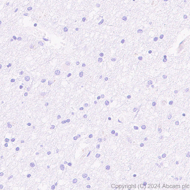 Immunohistochemistry (Formalin/PFA-fixed paraffin-embedded sections) - Anti-Stabilin-1 antibody [EPR27955-12] - BSA and Azide free (AB317257)