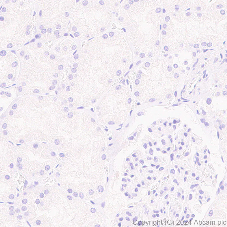 Immunohistochemistry (Formalin/PFA-fixed paraffin-embedded sections) - Anti-Stabilin-1 antibody [EPR27955-12] - BSA and Azide free (AB317257)