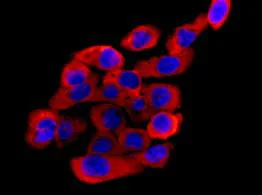 Immunocytochemistry/ Immunofluorescence - Anti-STAC antibody [EPR12805] - BSA and Azide free (AB250385)