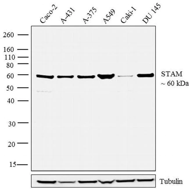 Western blot - Anti-STAM antibody [RP23040090] (AB308114)