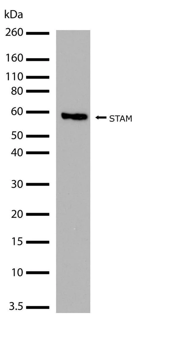 Western blot - Anti-STAM antibody [RP23040090] (AB308114)