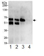 Immunoprecipitation - Anti-STAM1 antibody (AB117813), expandable thumbnail