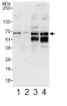 Western blot - Anti-STAM1 antibody (AB117813), expandable thumbnail