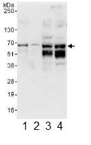 Western blot - Anti-STAM1 antibody (AB117813)