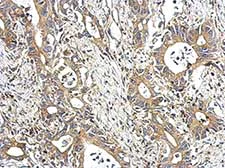 Immunohistochemistry (Formalin/PFA-fixed paraffin-embedded sections) - Anti-STAM1 antibody (AB155527)