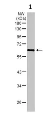 Western blot - Anti-STAM1 antibody (AB155527)