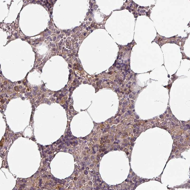Immunohistochemistry (Formalin/PFA-fixed paraffin-embedded sections) - Anti-STAM1 antibody (AB244470)