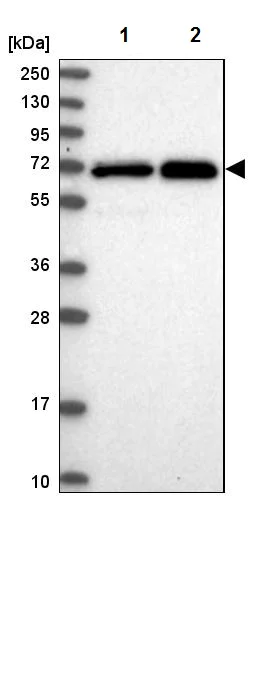 Western blot - Anti-STAM1 antibody (AB244470)