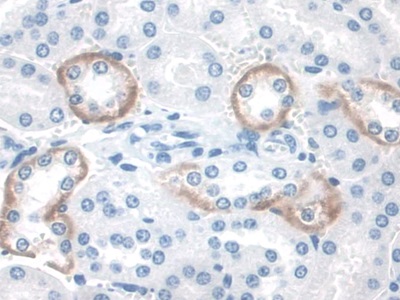 Immunohistochemistry (Formalin/PFA-fixed paraffin-embedded sections) - Anti-STAM2 antibody (AB231280)