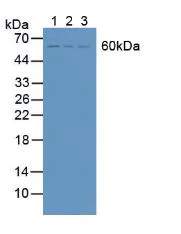 Western blot - Anti-STAM2 antibody (AB231280)