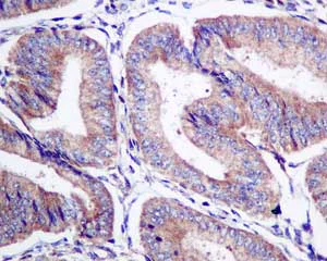 Immunohistochemistry (Formalin/PFA-fixed paraffin-embedded sections) - Anti-STAM2 antibody [EPR8688] (AB151545)
