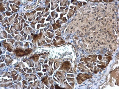 Immunohistochemistry (Formalin/PFA-fixed paraffin-embedded sections) - Anti-Stanniocalcin 1/STC antibody (AB229477)