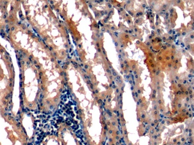 Immunohistochemistry (Formalin/PFA-fixed paraffin-embedded sections) - Anti-Stanniocalcin 1/STC antibody [C5] (AB239518), expandable thumbnail