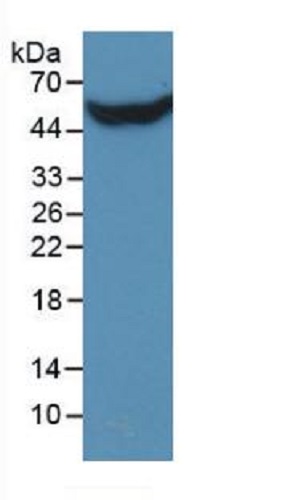 Western blot - Anti-Stanniocalcin 1/STC antibody [C5] (AB239518), expandable thumbnail