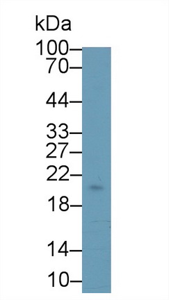 Western blot - Anti-Stanniocalcin 1/STC antibody [C5] (AB239518), expandable thumbnail