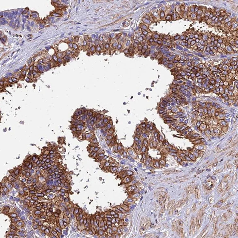 Immunohistochemistry (Formalin/PFA-fixed paraffin-embedded sections) - Anti-Stanniocalcin 2/STC-2 antibody (AB262857)