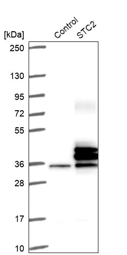 Western blot - Anti-Stanniocalcin 2/STC-2 antibody (AB262857)