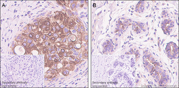Immunohistochemistry (Formalin/PFA-fixed paraffin-embedded sections) - Anti-Stanniocalcin 2/STC-2 antibody [EPR22866-10] (ab255610), expandable thumbnail