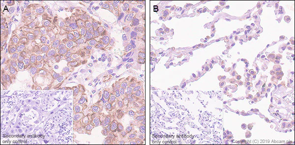 Immunohistochemistry (Formalin/PFA-fixed paraffin-embedded sections) - Anti-Stanniocalcin 2/STC-2 antibody [EPR22866-10] (AB255610)