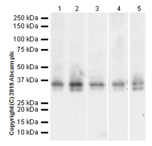 Western blot - Anti-Stanniocalcin 2/STC-2 antibody [EPR22866-10] (AB255610), expandable thumbnail