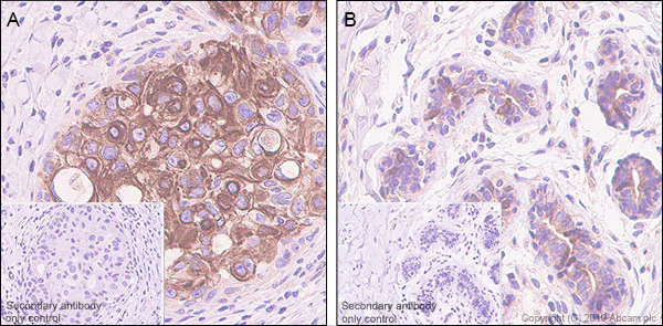 Immunohistochemistry (Formalin/PFA-fixed paraffin-embedded sections) - Anti-Stanniocalcin 2/STC-2 antibody [EPR22866-10] - BSA and Azide free (AB261915)