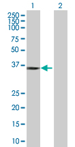 Western blot - STAP-1 overexpression 293T lysate (whole cell) (AB94204), expandable thumbnail