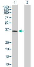 Western blot - STAP-1 overexpression 293T lysate (whole cell) (AB94204)