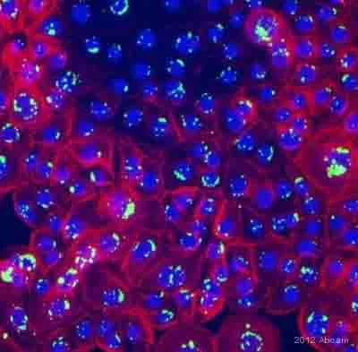 Immunocytochemistry/ Immunofluorescence - Anti-Staphylococcus aureus antibody (AB20920)