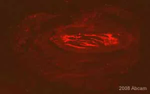 Immunohistochemistry (Frozen sections) - Anti-Staphylococcus aureus antibody (AB20920)