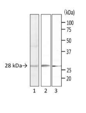 Western blot - Anti-Staphylococcus Enterotoxin A antibody [SA01] (AB243103), expandable thumbnail