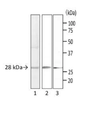 Western blot - Anti-Staphylococcus Enterotoxin A antibody [SA01] (AB243103)