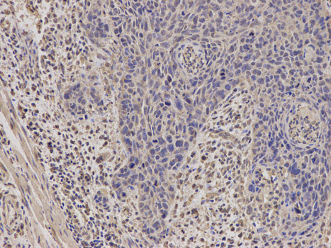 Immunohistochemistry (Formalin/PFA-fixed paraffin-embedded sections) - Anti-StAR antibody (AB180804)