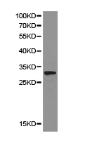 Western blot - Anti-StAR antibody (AB180804)