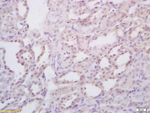 Immunohistochemistry (Formalin/PFA-fixed paraffin-embedded sections) - Anti-StAR antibody (AB203193)