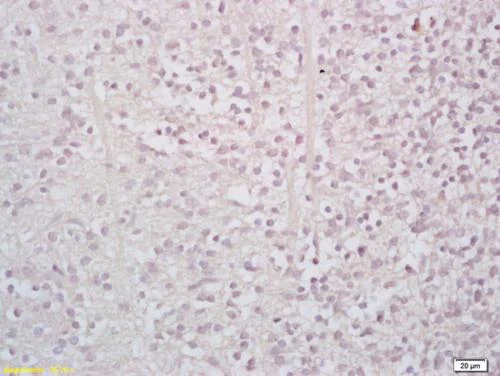 Immunohistochemistry (Formalin/PFA-fixed paraffin-embedded sections) - Anti-StAR antibody (AB203193)