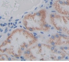 Immunohistochemistry (Formalin/PFA-fixed paraffin-embedded sections) - Anti-StAR antibody (AB233427)