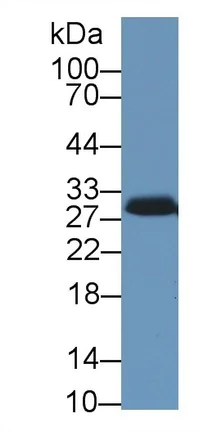 Western blot - Anti-StAR antibody (AB233427)