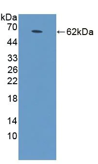 Western blot - Anti-StAR antibody (AB233427)