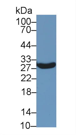 Western blot - Anti-StAR antibody (AB233427)