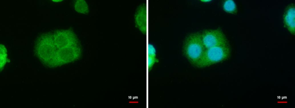 Immunocytochemistry/ Immunofluorescence - Anti-StAR antibody (AB96637)