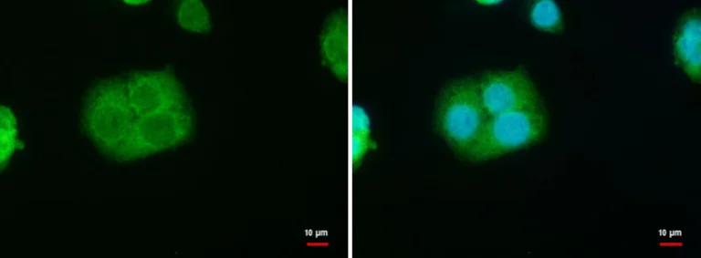 Immunocytochemistry/ Immunofluorescence - Anti-StAR antibody (AB96637)
