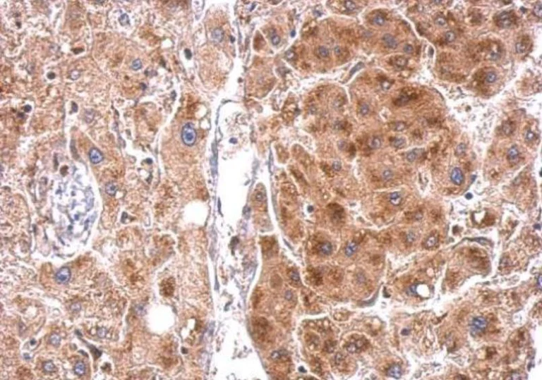 Immunohistochemistry (Formalin/PFA-fixed paraffin-embedded sections) - Anti-StAR antibody (AB96637)